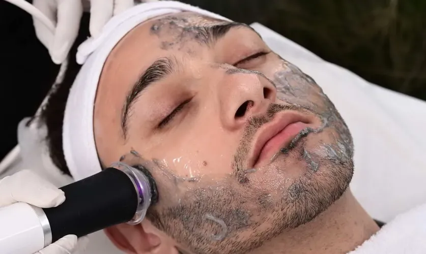 Black Peel Treatment