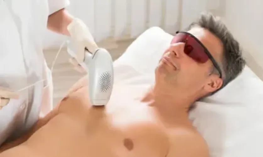 Laser Toning for Chest Treatment