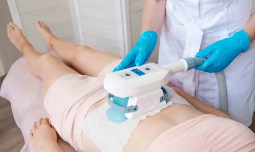 Cool Sculpting Surgery