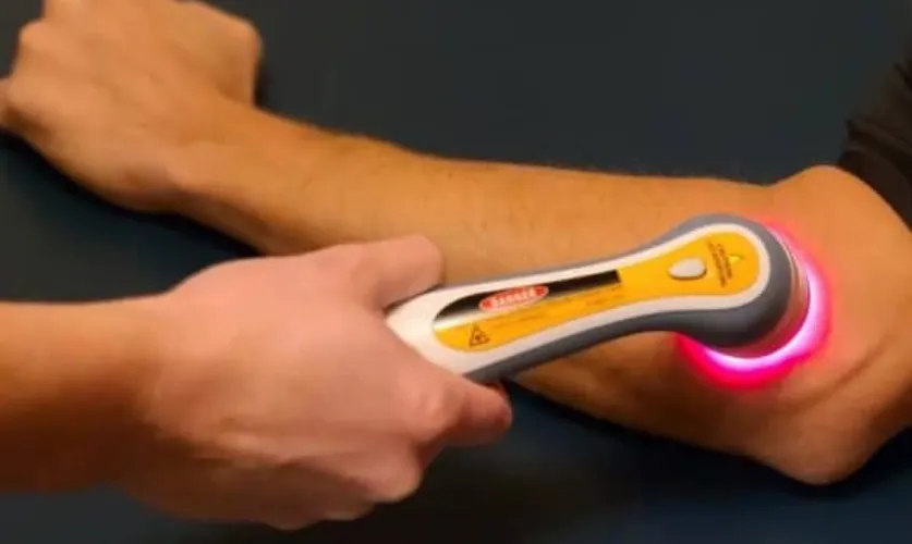 Laser Toning for Elbows Treatment