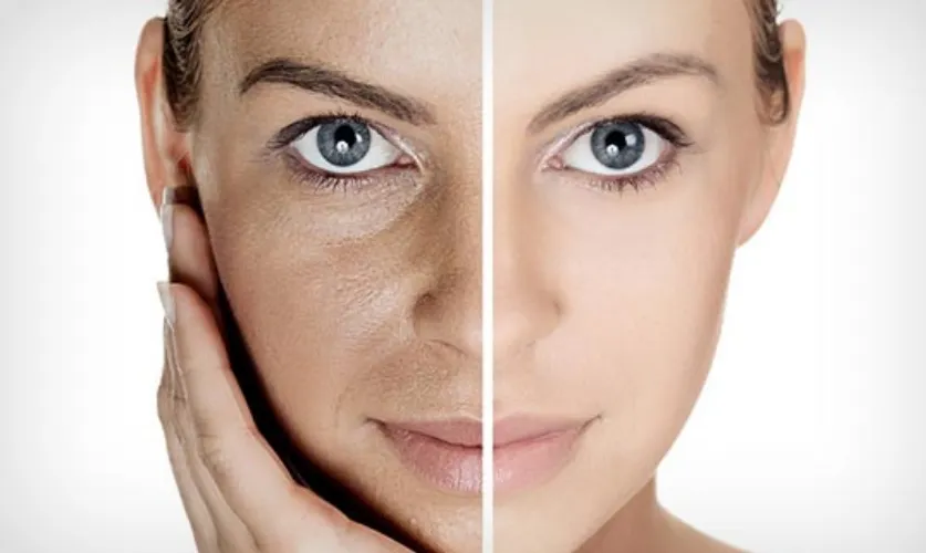 Facial Rejuvenation Treatment