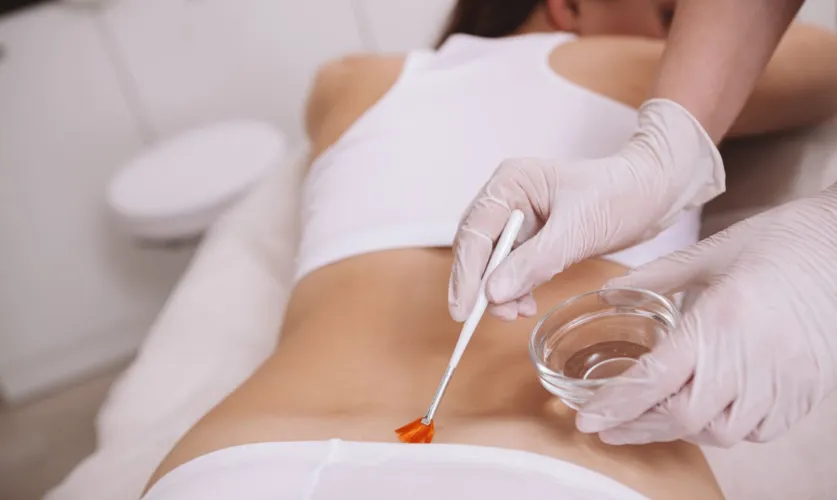 Full Body Peel Treatment