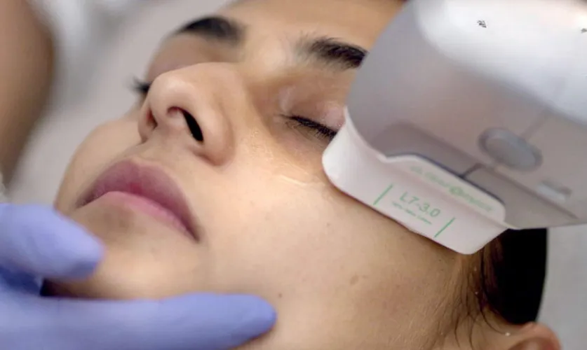HIFU Treatment