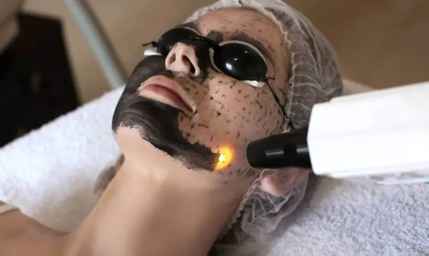Hollywood / Carbon Facial / Black Doll Facial Treatment