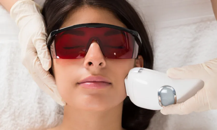Laser Hair Reduction Treatment