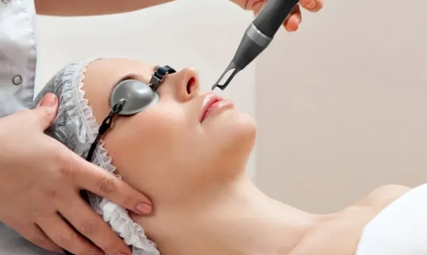 Laser Photo Facial Treatment
