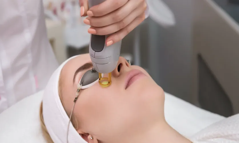 Laser Treatment for Scar & Pigmentation Treatment