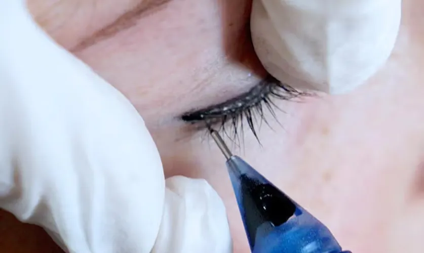 Lash Line Enhancement Treatment