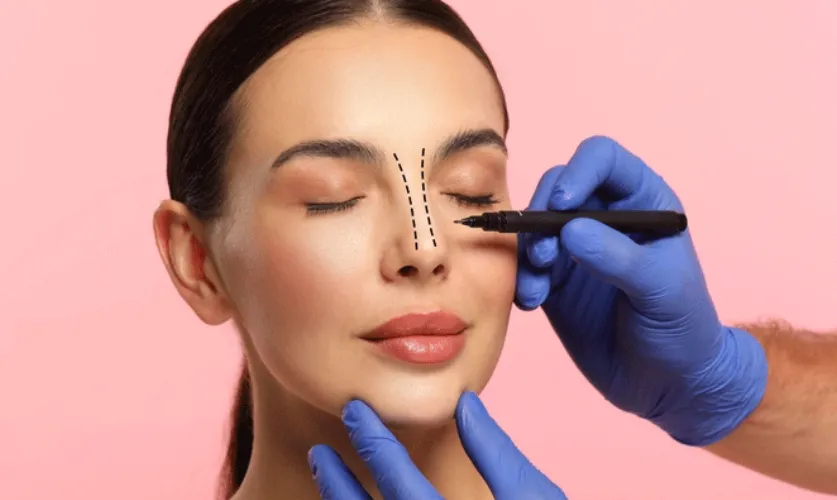 Rhinoplasty Surgery